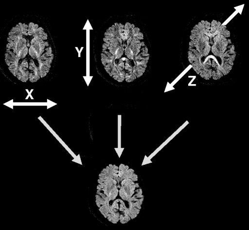 Diffusion Imaging
