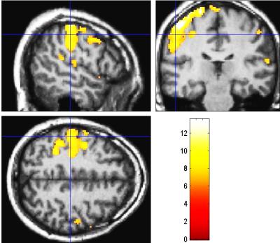 functional MRI