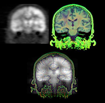 Multi-modality imaging