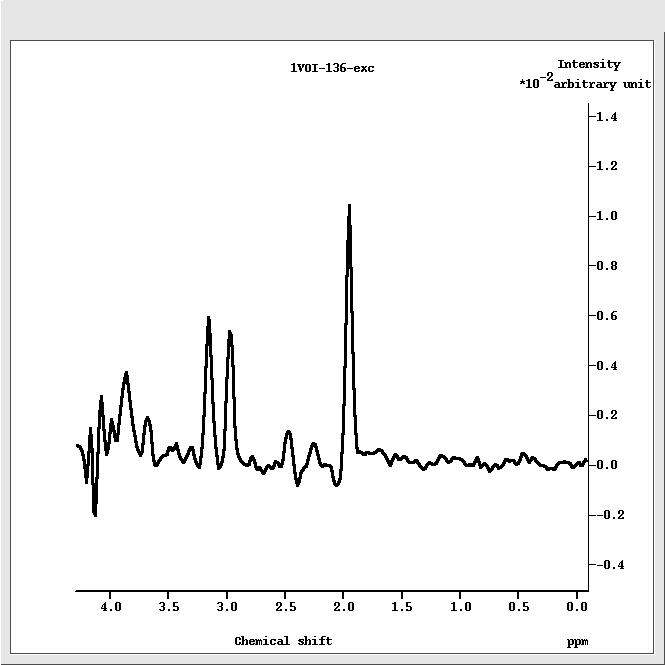 Single-voxel spectroscopy